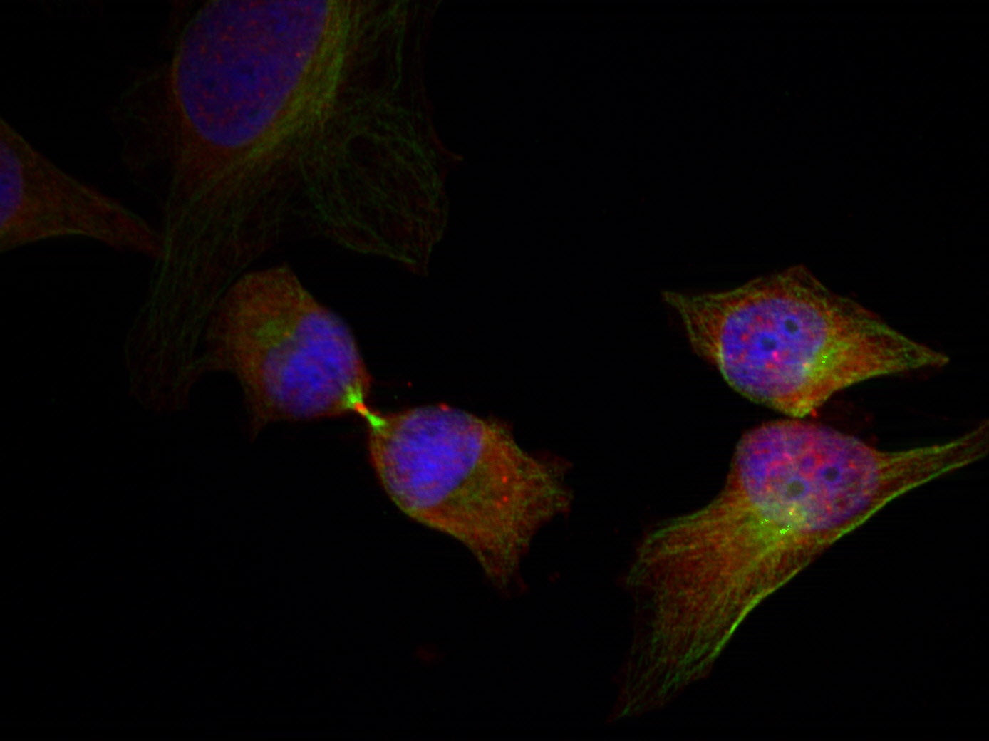 Anti-Phospho-Hsp27 (Ser78) Rabbit Polyclonal Antibody