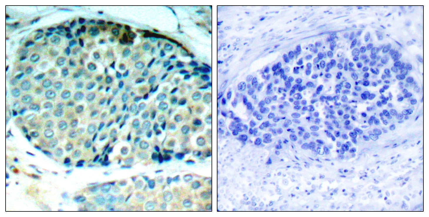 Anti-Phospho-Hsp27 (Ser78) Rabbit Polyclonal Antibody