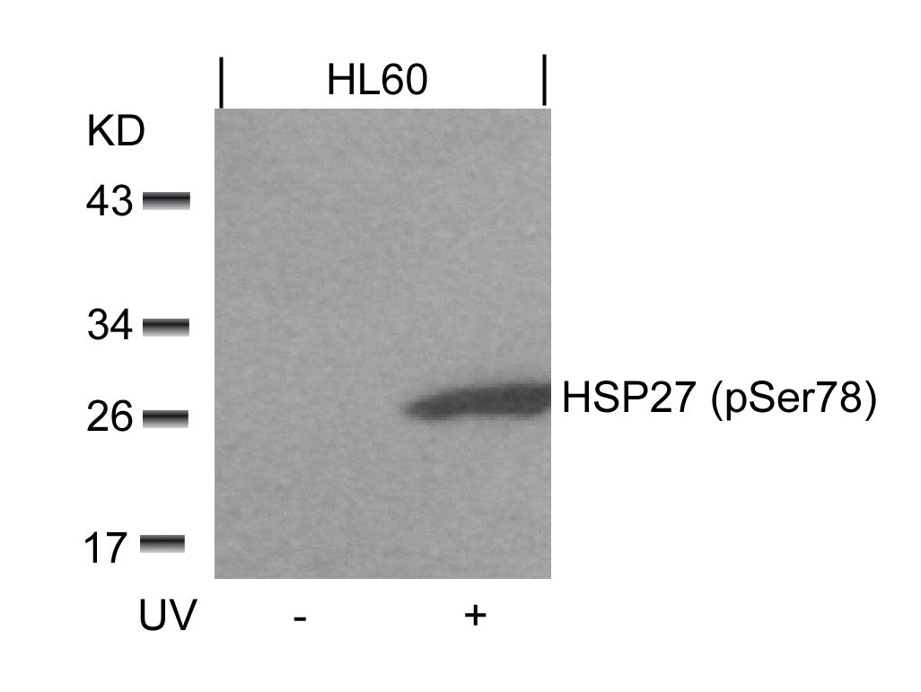Anti-Phospho-Hsp27 (Ser78) Rabbit Polyclonal Antibody