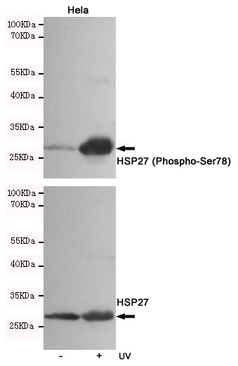 Anti-Phospho-Hsp27 (Ser78) Rabbit Polyclonal Antibody