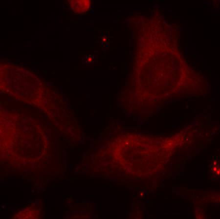 Anti-Phospho-NF-KB p105 (Ser927) Rabbit Polyclonal Antibody