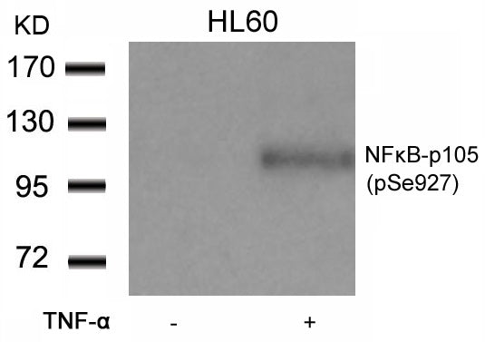 Anti-Phospho-NF-KB p105 (Ser927) Rabbit Polyclonal Antibody