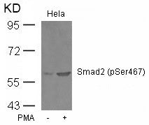 Anti-Phospho-Smad2 (Ser467) Rabbit Polyclonal Antibody