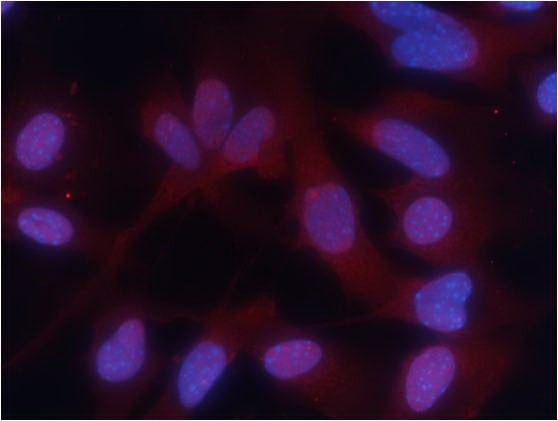 Anti-Phospho-PKM2 (Ser37) Rabbit Polyclonal Antibody