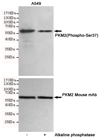 Anti-Phospho-PKM2 (Ser37) Rabbit Polyclonal Antibody