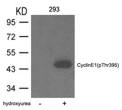 Anti-Phospho-Cyclin E1 (Thr395) Rabbit Polyclonal Antibody