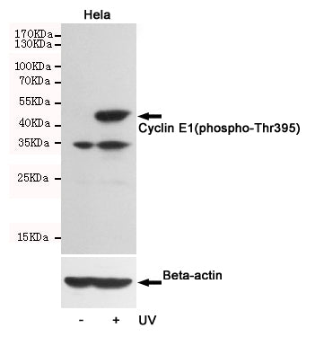 Anti-Phospho-Cyclin E1 (Thr395) Rabbit Polyclonal Antibody