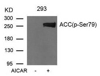 Anti-Phospho-Acetyl Coenzyme A Carboxylase (Ser79) Rabbit Polyclonal Antibody
