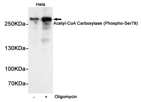 Anti-Phospho-Acetyl Coenzyme A Carboxylase (Ser79) Rabbit Polyclonal Antibody