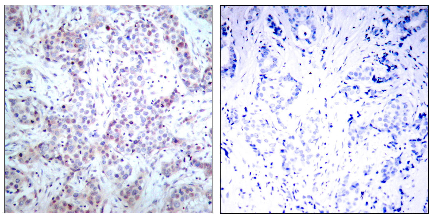 Anti-NF-KB p65 Rabbit Polyclonal Antibody