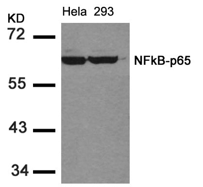 Anti-NF-KB p65 Rabbit Polyclonal Antibody