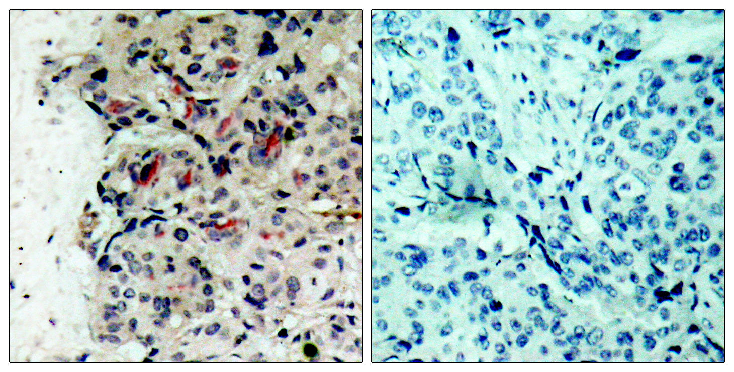 Anti-JAK1 Rabbit Polyclonal Antibody