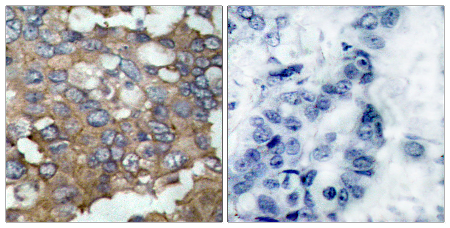 Anti-Src Rabbit Polyclonal Antibody