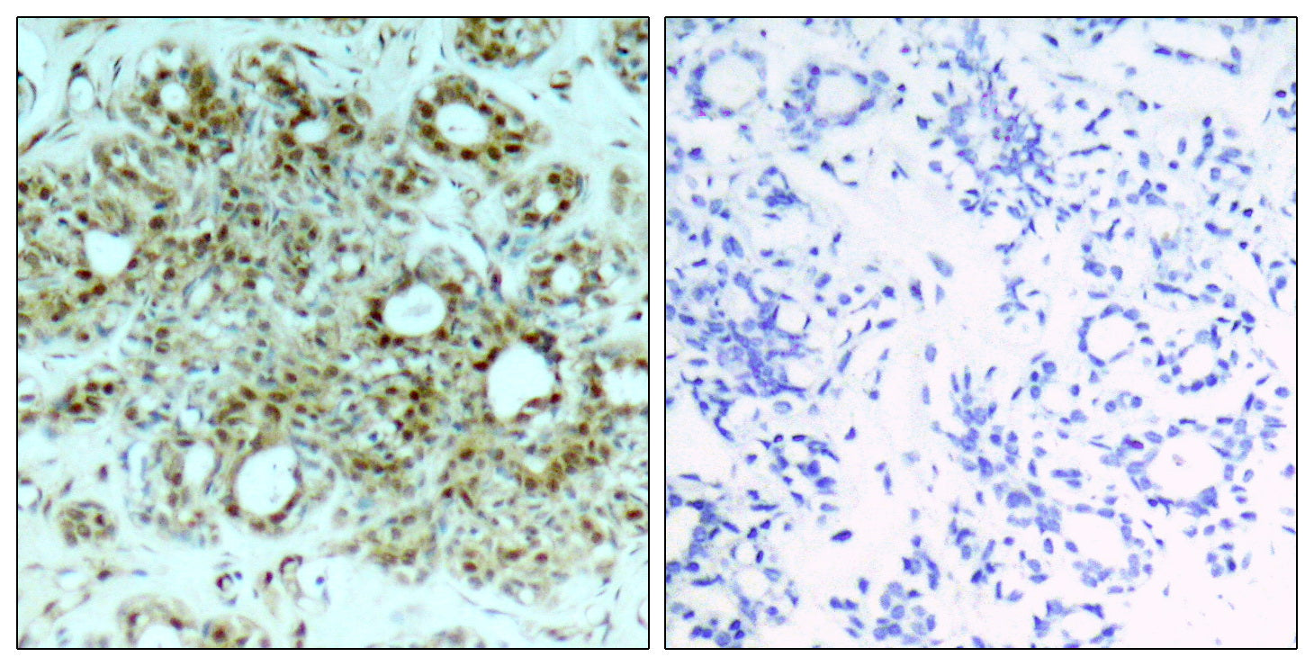 Anti-NF-KB p65 Rabbit Polyclonal Antibody