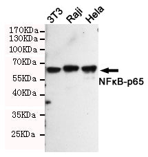 Anti-NF-KB p65 Rabbit Polyclonal Antibody