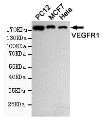 Anti-VEGF Receptor 1 Rabbit Polyclonal Antibody