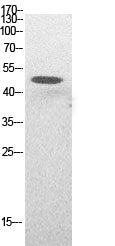 Anti-Acetyl-p53 (Lys382) Rabbit Polyclonal Antibody