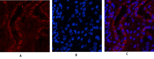 Anti-ER beta Rabbit Polyclonal Antibody