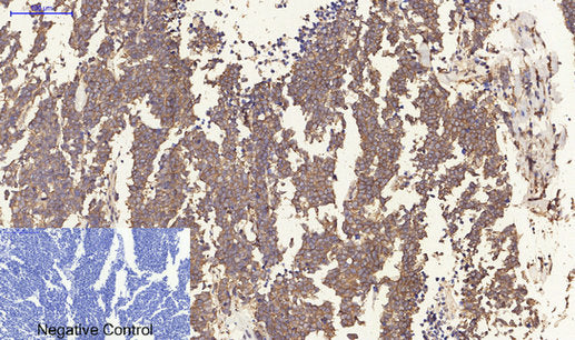 Anti-ER beta Rabbit Polyclonal Antibody