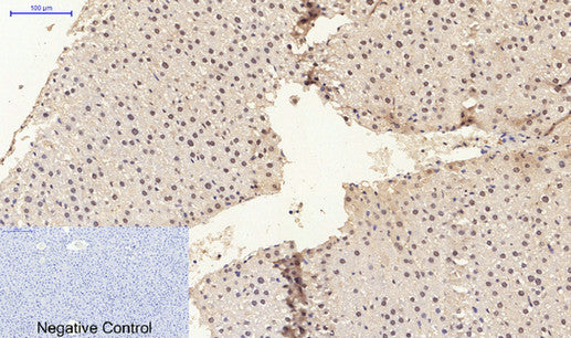Anti-ER beta Rabbit Polyclonal Antibody