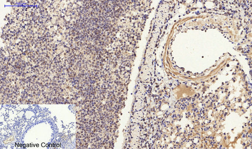 Anti-ER beta Rabbit Polyclonal Antibody