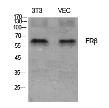 Anti-ER beta Rabbit Polyclonal Antibody