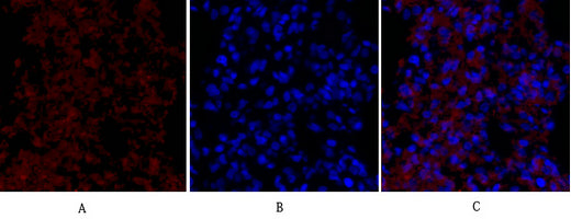 Anti-VEGF Receptor 2 Rabbit Polyclonal Antibody