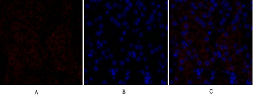 Anti-VEGF Receptor 2 Rabbit Polyclonal Antibody