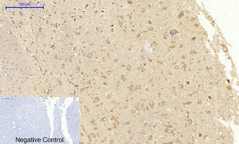 Anti-VEGF Receptor 2 Rabbit Polyclonal Antibody