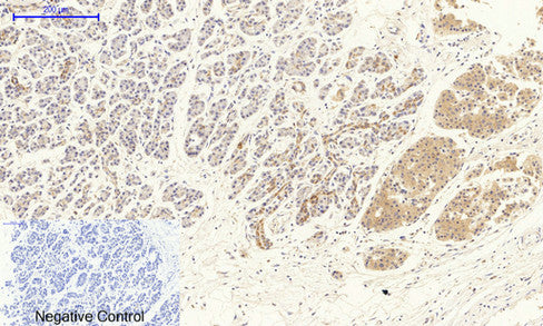 Anti-VEGF Receptor 2 Rabbit Polyclonal Antibody