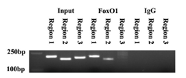 Anti-FOXO1 Rabbit Polyclonal Antibody