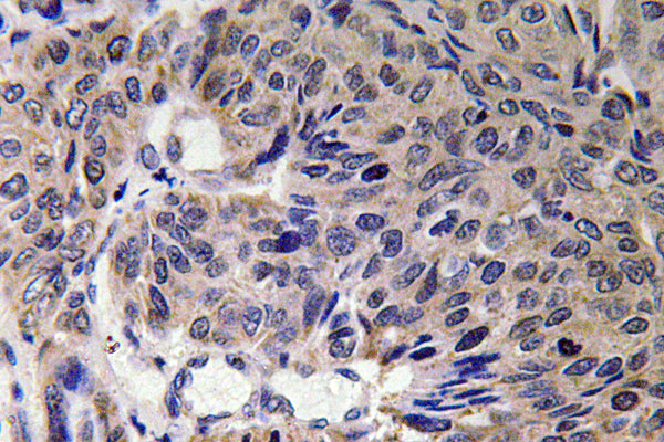 Anti-Mitofusin 2 Rabbit Polyclonal Antibody