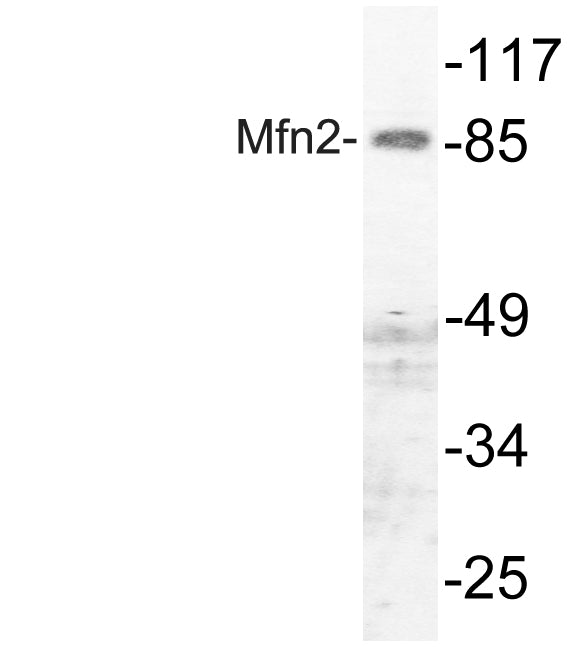 Anti-Mitofusin 2 Rabbit Polyclonal Antibody
