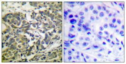 Anti-Phospho-AMPK alpha 1/2 (Thr183/Thr172) Rabbit Polyclonal Antibody