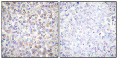 Anti-Phospho-AMPK alpha 1/2 (Thr183/Thr172) Rabbit Polyclonal Antibody