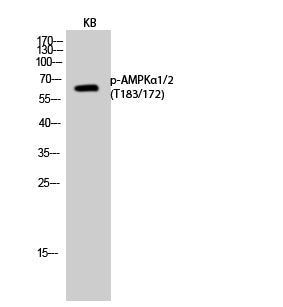 Anti-Phospho-AMPK alpha 1/2 (Thr183/Thr172) Rabbit Polyclonal Antibody