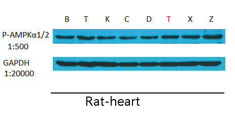 Anti-Phospho-AMPK alpha 1/2 (Thr183/Thr172) Rabbit Polyclonal Antibody