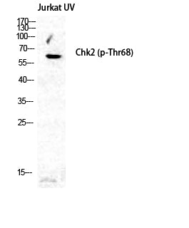 Anti-Phospho-Chk2 (Thr68) Rabbit Polyclonal Antibody