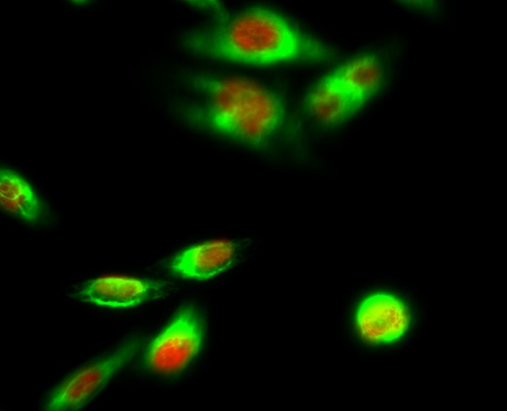 Anti-PPAR alpha Rabbit Polyclonal Antibody