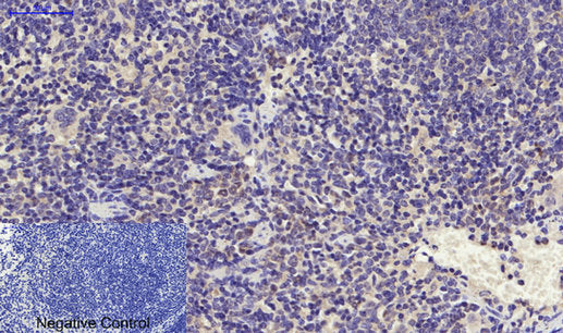 Anti-PPAR alpha Rabbit Polyclonal Antibody