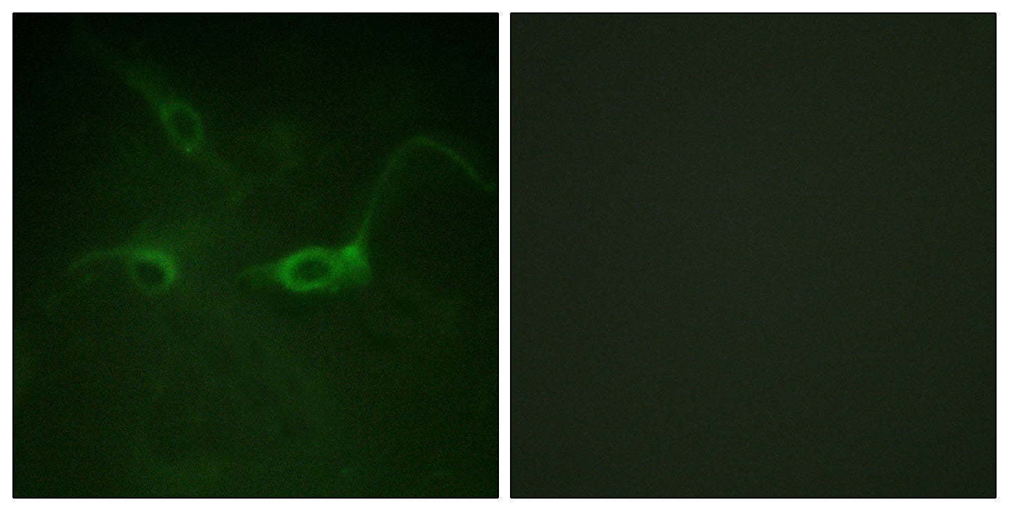 Anti-Phospho-FGFR1 (Tyr654) Rabbit Polyclonal Antibody