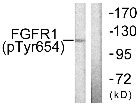 Anti-Phospho-FGFR1 (Tyr654) Rabbit Polyclonal Antibody