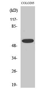 Anti-Phospho-AKT (Thr308) Rabbit Polyclonal Antibody