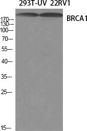 Anti-BRCA1 Rabbit Polyclonal Antibody