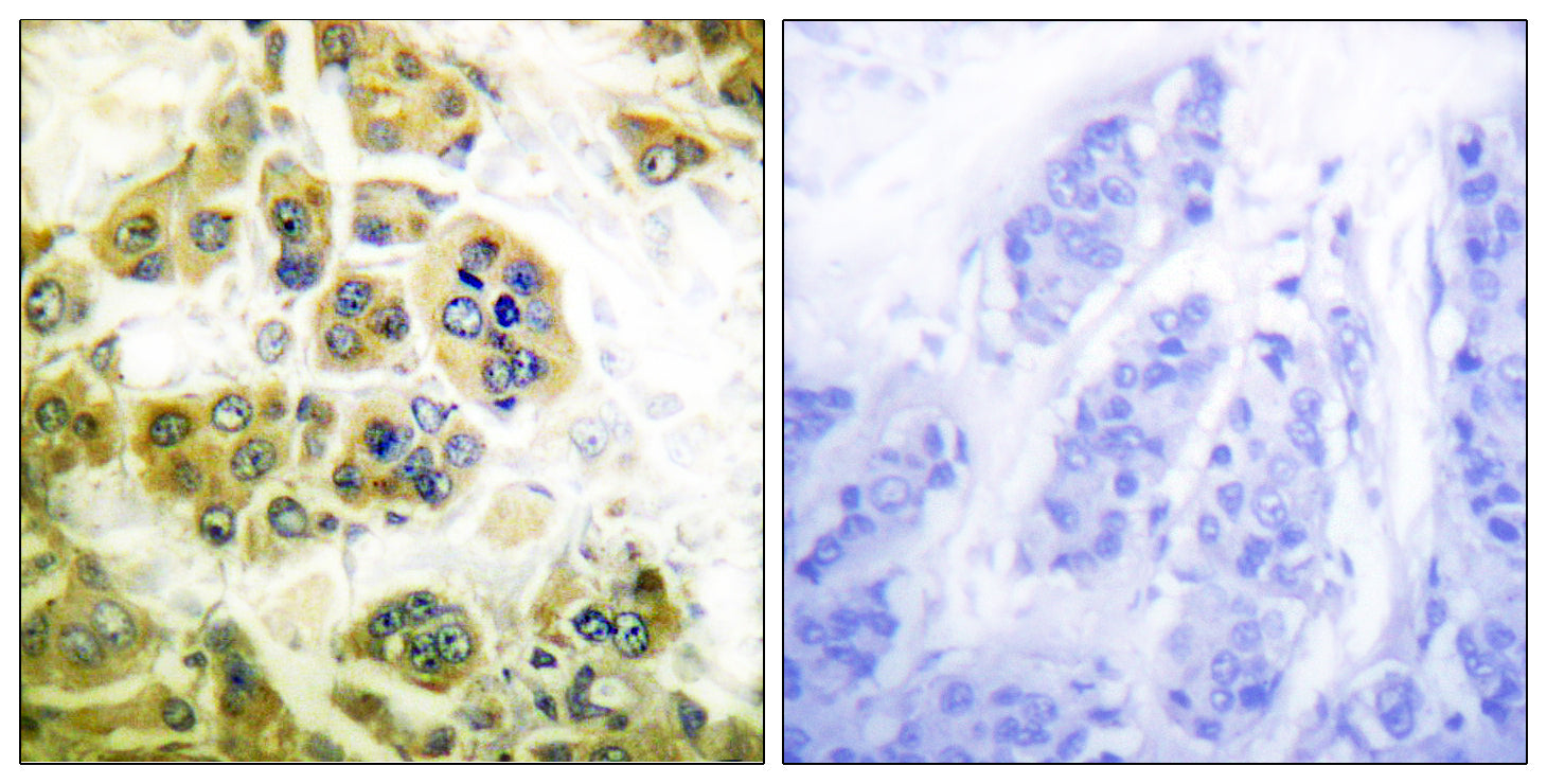 Anti-IKK alpha/beta Rabbit Polyclonal Antibody