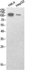 Anti-SREBP1 Rabbit Polyclonal Antibody