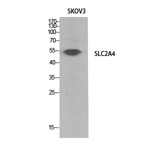 Anti-Glucose Transporter GLUT4 Rabbit Polyclonal Antibody
