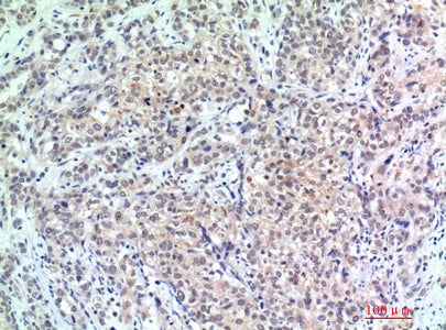Anti-p300 Rabbit Polyclonal Antibody