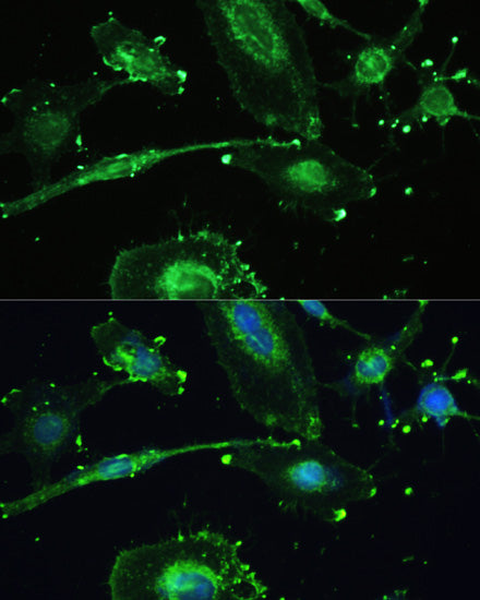 Anti-TREM2 Rabbit Polyclonal Antibody