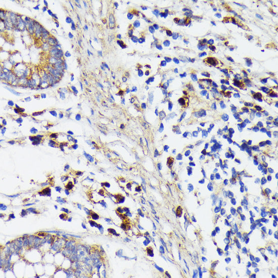 Anti-TREM2 Rabbit Polyclonal Antibody